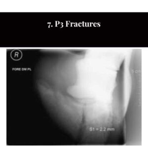 7. P3 Fractures